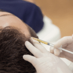 PRP Hair Treatment: What the Success Rates Really Reveal
